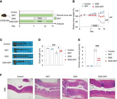 A Japanese Herbal Formula, Daikenchuto, Alleviates Experimental Colitis by Reshaping Microbial Profiles and Enhancing Group 3 Innate Lymphoid Cells